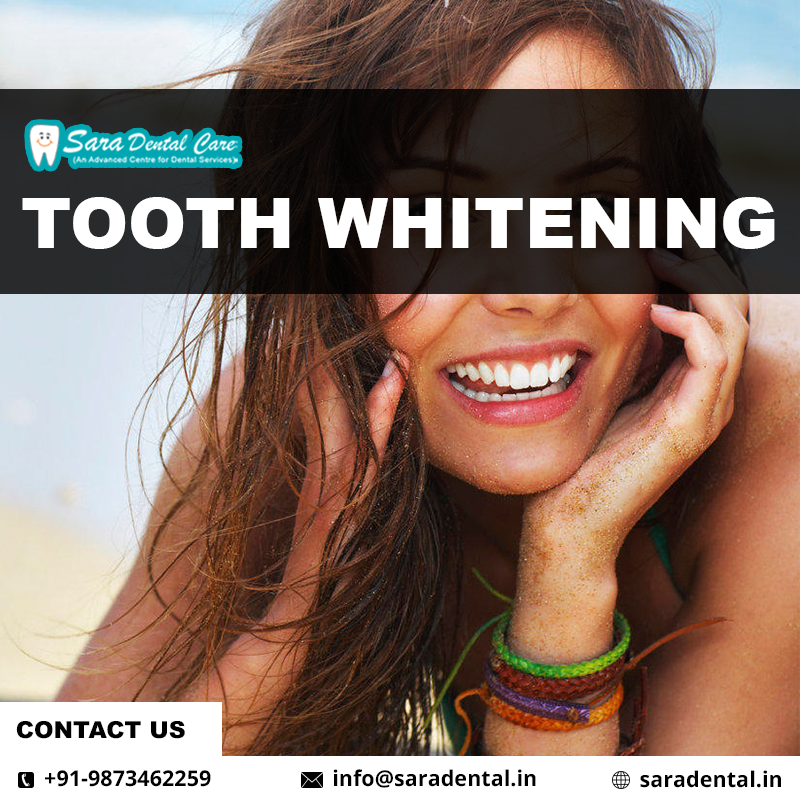 Tooth Whitening copy